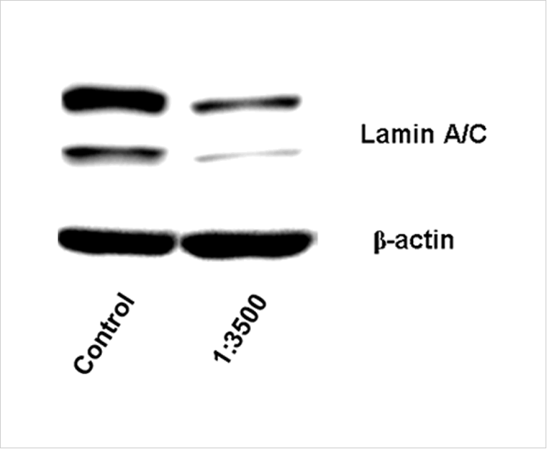 Lipid Nano Particle（LNP）の模式図