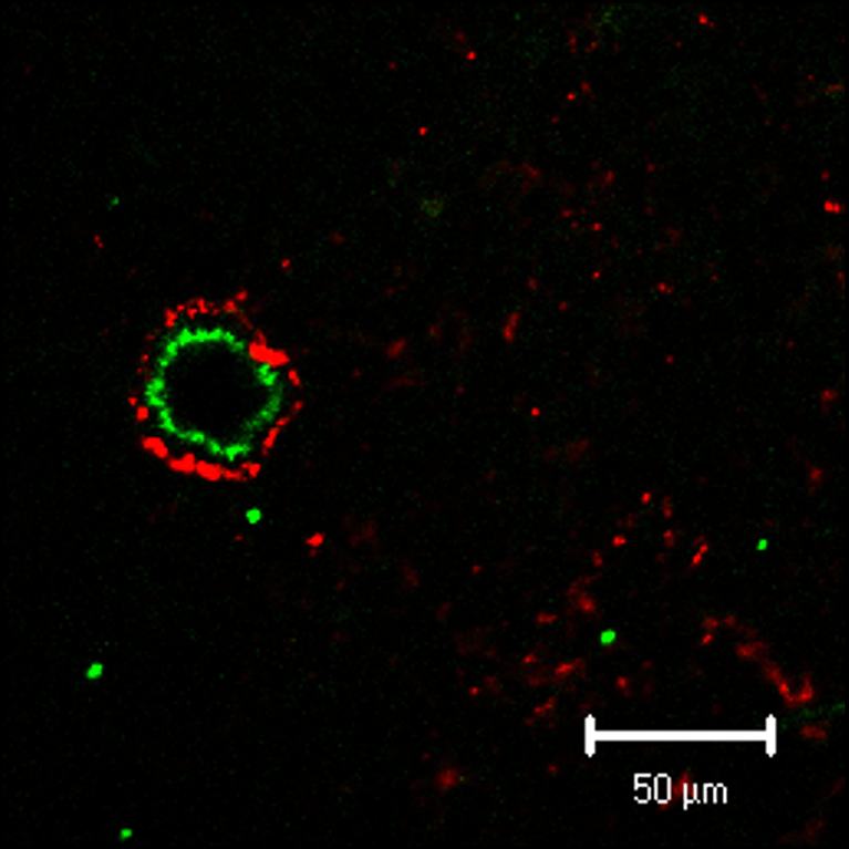 PEG-modified liposome