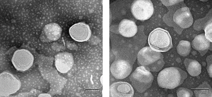 Liposome